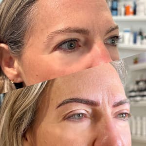 Eyebrow Tattoo result by Skin 4 Glow in Mohegan Lake, NY