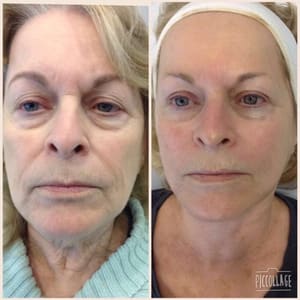 Eyebrow Tattoo result by Skin Care With Dawn in Indialantic, FL