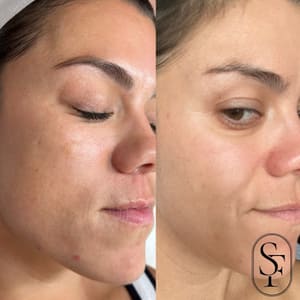 Eyebrow Tattoo result by Skin Firm Aesthetics in Cave Spring, VA