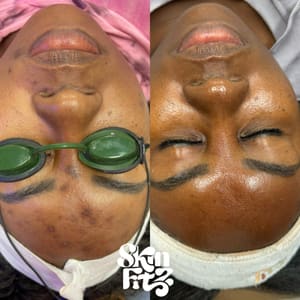 Eyebrow Tattoo result by Skin Fitz: Esthetics & Laser in Monroe, LA