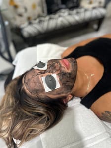Eyebrow Tattoo result by Skin Time Rx - Laser Aesthetics in Pleasanton, CA