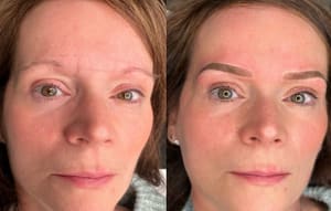 Eyebrow Tattoo result by SKINK by Claudia - Micropigmentacion, Natural brows, Lip Blush & Paramedical Tattoo in Pembroke Pines, FL