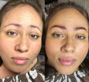 Eyebrow Tattoo result by SKINK by Claudia - Micropigmentacion, Natural brows, Lip Blush & Paramedical Tattoo in Pembroke Pines, FL