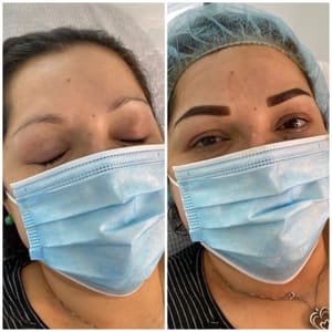 Eyebrow Tattoo result by Skinlab Medspa Jupiter in Jupiter, FL