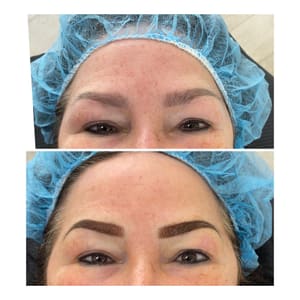 Eyebrow Tattoo result by Skinlab Medspa Jupiter in Jupiter, FL