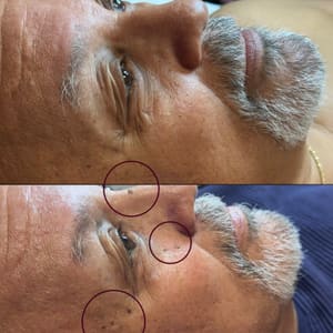 Eyebrow Tattoo result by Skinthetics Beauty in West Covina, CA