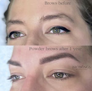 Eyebrow Tattoo result by SKN ALLEGIANCE Laser tattoo & Permanent makeup removal in Huntingdon Valley, PA