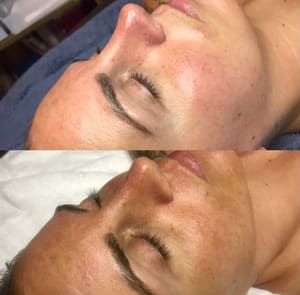 Eyebrow Tattoo result by SPA SUITES by Jem Esthetics LLC in New Haven, CT