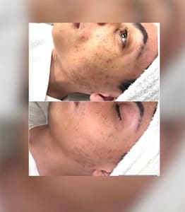 Eyebrow Tattoo result by Stels Beauty Wellness and Med Spa in Niantic, CT