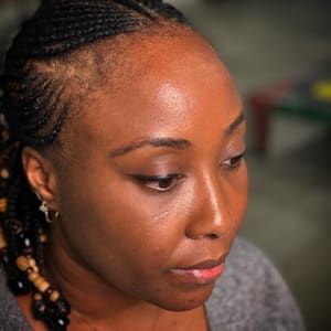 Eyebrow Tattoo result by Stevey G Scalp Micropigmentation in Miami, FL