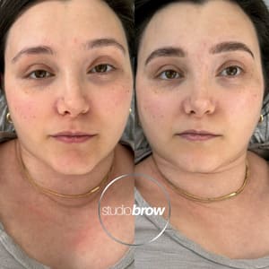 Eyebrow Tattoo result by Studio Brow in Peekskill, NY