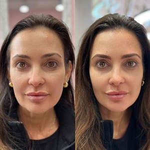 Eyebrow Tattoo result by Stylisee Microblading in Chicago, IL