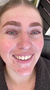 Eyebrow Tattoo result by Super Brow & Lash Bar Palatine in Palatine, IL