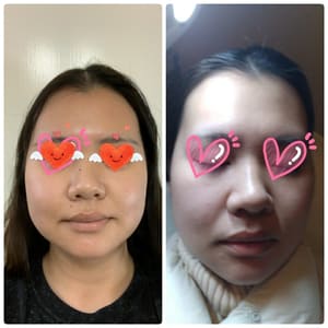 Eyebrow Tattoo result by Suzy’s skin care in Santa Clara, CA