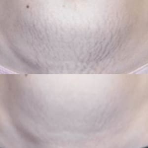 Eyebrow Tattoo result by Symmetry the Aesthetics Studio and Spa in Ashland, KY