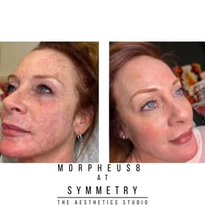 Eyebrow Tattoo result by Symmetry the Aesthetics Studio and Spa in Ashland, KY