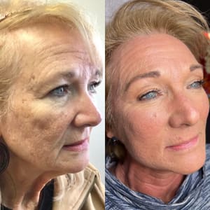 Eyebrow Tattoo result by Symmetry the Aesthetics Studio and Spa in Ashland, KY