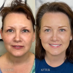 Eyebrow Tattoo result by Tamier Brows in Chula Vista, CA
