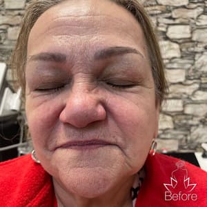 Eyebrow Tattoo result by Tender Touch Esthetic in Altamonte Springs, FL