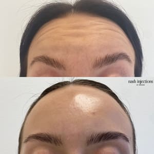 Eyebrow Tattoo result by The Aesthetics Club Nashville - By Nash Injections by Hannah in Nashville, TN