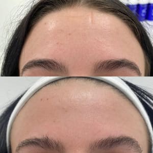Eyebrow Tattoo result by The Aesthetics Club Nashville - By Nash Injections by Hannah in Nashville, TN