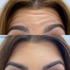 Eyebrow Tattoo result by The Aesthetics Club Nashville - By Nash Injections by Hannah in Nashville, TN