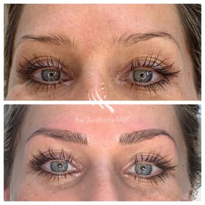 Eyebrow Tattoo result by the Aesthetix LAB in Bellevue, WA
