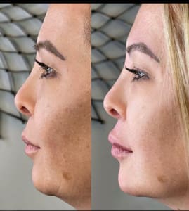 Eyebrow Tattoo result by The Bar in Costa Mesa, CA