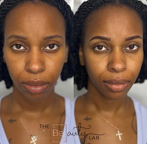 Eyebrow Tattoo result by The Beauty Lab Tampa in Tampa, FL