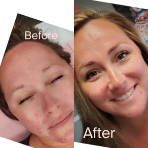 Eyebrow Tattoo result by The Brow Cabin - Microblading, Powder Brows & Permenant Makeup in Spring Hill, FL