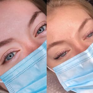 Eyebrow Tattoo result by The Brow Dude Permanent Make Up Studio in Miami, FL