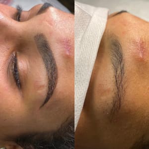 Eyebrow Tattoo result by The Brow Fairy in Bronx, NY