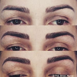 Eyebrow Tattoo result by The Brow Nurse in Redlands, CA