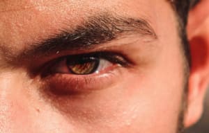 Eyebrow Tattoo result by The BrowGal in West Hollywood, CA