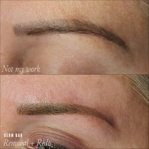 Eyebrow Tattoo result by The Derm Bar STL in Creve Coeur, MO