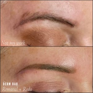 Eyebrow Tattoo result by The Derm Bar STL in Creve Coeur, MO
