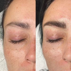 Eyebrow Tattoo result by The Goodface in Portland, OR