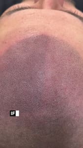 Eyebrow Tattoo result by The SMP Spot in Bakersfield, CA