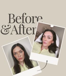 Eyebrow Tattoo result by Thee Best Brows Miami in Miami, FL