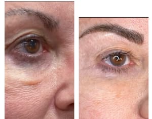 Eyebrow Tattoo result by Timeless Body and Brows in La Mesa, CA