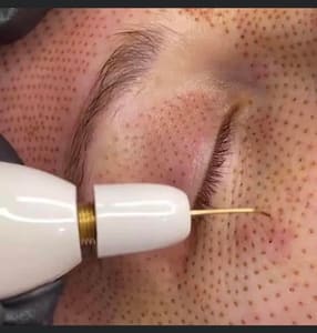 Eyebrow Tattoo result by Timeless Body and Brows in La Mesa, CA