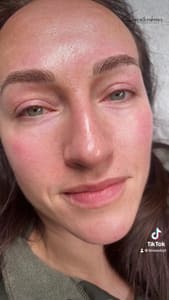 Eyebrow Tattoo result by Tran's SignatureBrows and Permanent Make up in San Jose, CA
