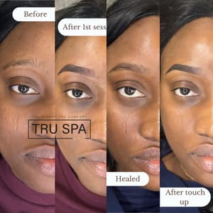 Eyebrow Tattoo result by Tru Spa by Heba in Carmel, IN