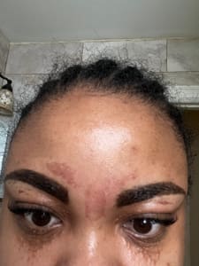 Eyebrow Tattoo result by Tsahai Beauty in St Albans, NY