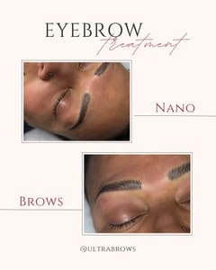 Eyebrow Tattoo result by Ultra Brows in Summerville, SC