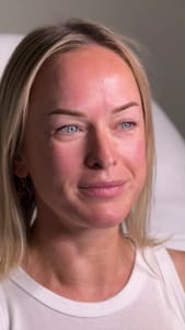 Eyebrow Tattoo result by Umut Permanent Makeup Bellevue in Bellevue, WA