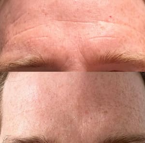 Eyebrow Tattoo result by Urban Beauty Salon & Medspa in Salem, OH