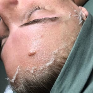 Eyebrow Tattoo result by V's Skin Studio LLC in Appleton, WI