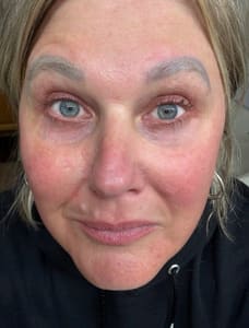 Eyebrow Tattoo result by Vanish Laser Services in Pensacola, FL