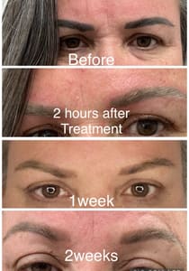Eyebrow Tattoo result by Vanish Laser Services in Pensacola, FL